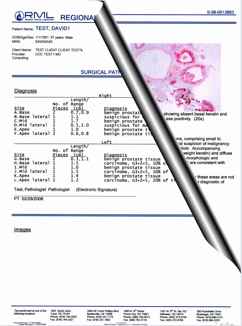 Medical Lab Results Template Fresh Pathology Report Examples